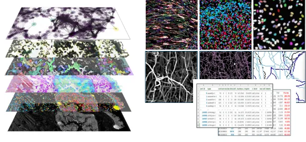 複雑な構造のセグメンテーション深層・事前学習など使用(Cellpose、StarDist、I-H-Watershed、Flood Filling Net)